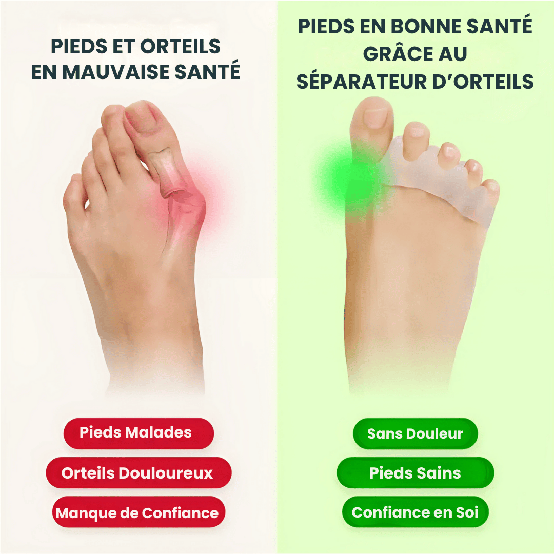 Écarteurs d'orteils