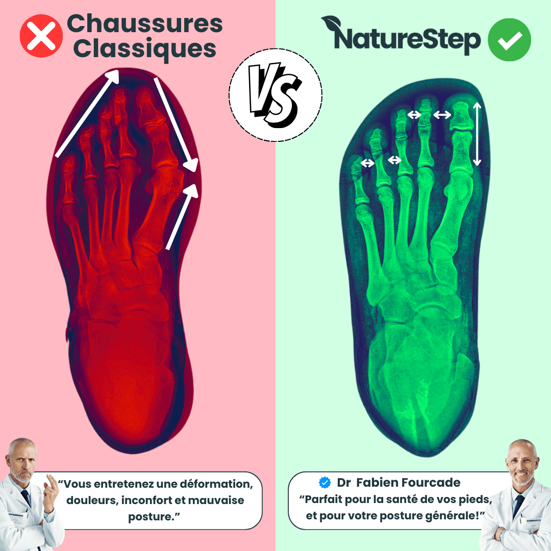 Vortex NatureStep™